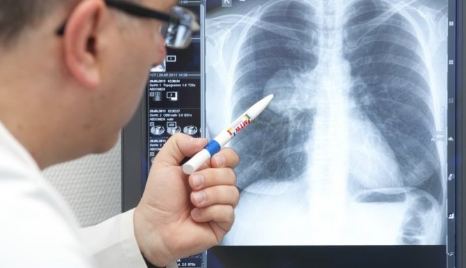 Bakıda yayılan xəstəlik təhlükəli H3N2 virusudur? - həkimdən xəbərdarlıq