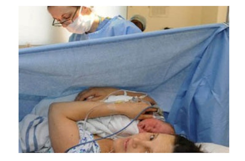 Həkimlərin çoxu keysəriyyə can atır — Ginekoloqdan İRAD