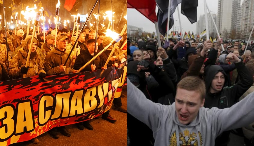 Siam əkizləri-rusun ayağı, ukraynalının başı...