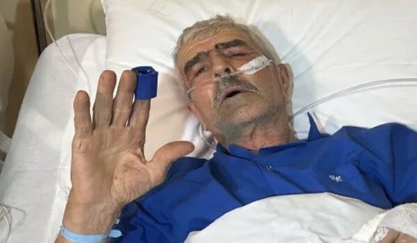 Təyyarə qəzasında yaralanan Nurullah Siracov vəfat etdi