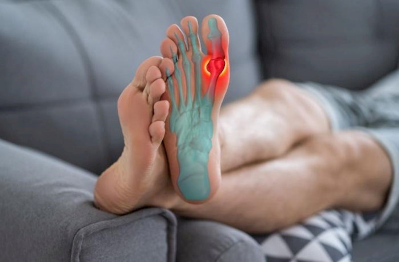 Podaqra riskini artıran içkilər açıqlandı