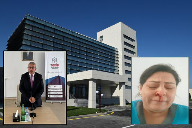 Döyüldüyünü iddia edən işçi barədə TƏBİB-dən AÇIQLAMA